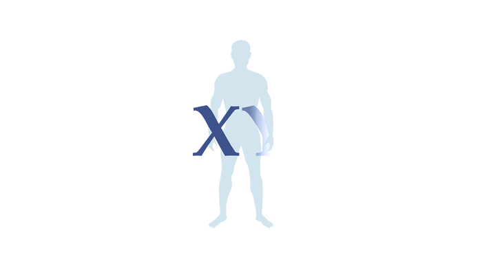 A decade of studies on the Loss of Y chromosome